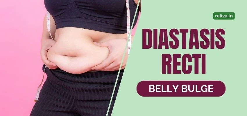Diastasis Recti